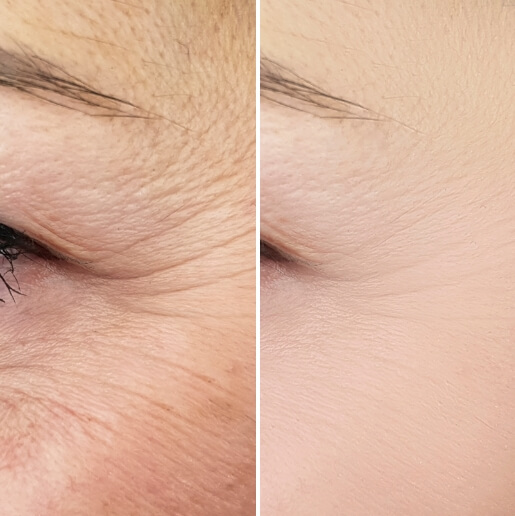 Irina z Vişeu de Sus